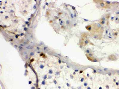 2 - Anti-DMRT1 Antibody ABO12761