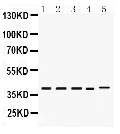 1 - Anti-DMRT1 Antibody ABO12761