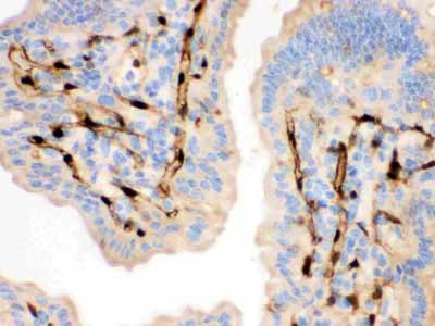 2 - Anti-FABP4 Antibody ABO12762