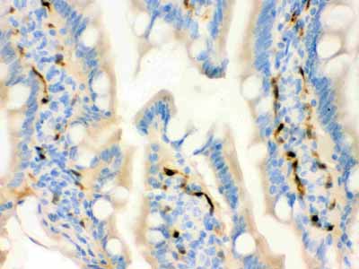 2 - Anti-FABP4 Antibody ABO12762