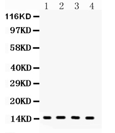 1 - Anti-FABP4 Antibody ABO12762