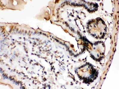 2 - Anti-Fos B Antibody ABO12763