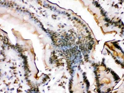 2 - Anti-Fos B Antibody ABO12763