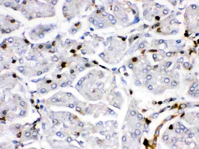 2 - Anti-Fos B Antibody ABO12763