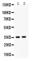 1 - Anti-Fos B Antibody ABO12763