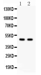 1 - Anti-PTOV1 Antibody ABO12764