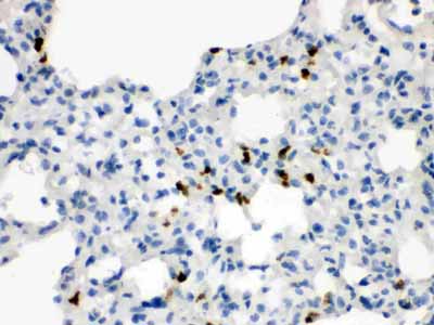 2 - Anti-Wnt7a Antibody ABO12765