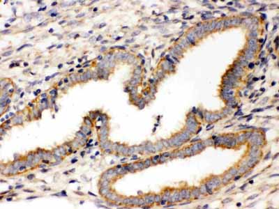 2 - Anti-Wnt7a Antibody ABO12765