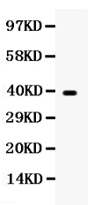 1 - Anti-Wnt7a Antibody ABO12765