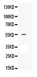 1 - Anti-MMP-12 Antibody ABO12766