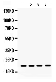 1 - Anti-NM23A Antibody ABO12767