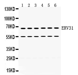 1 - Anti-ERV31 Antibody ABO12768