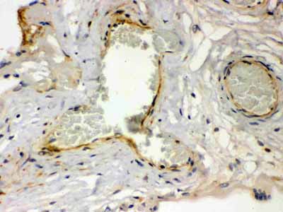 2 - Anti-Thrombin Receptor Antibody ABO12769
