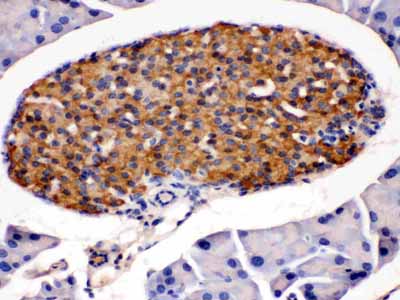 2 - Anti-HSD11B2 Antibody ABO12771