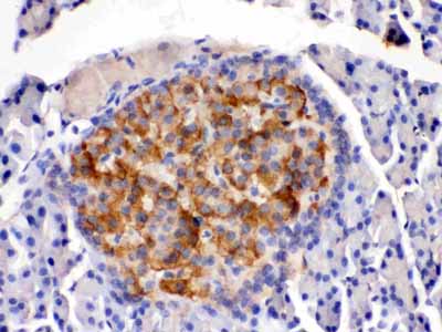 2 - Anti-HSD11B2 Antibody ABO12771