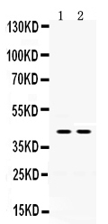 1 - Anti-HSD11B2 Antibody ABO12771