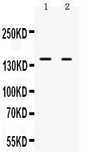 1 - Anti-RIP140 Antibody ABO12772