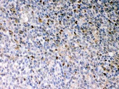 2 - Anti-PU.1/Spi1 Antibody ABO12773