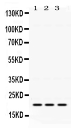 1 - Anti-GTPase HRAS Antibody ABO12774