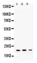 1 - Anti-GTPase HRAS Antibody ABO12775