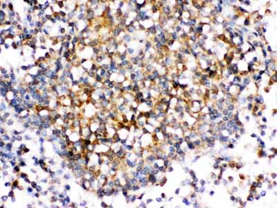 2 - Anti-CD30L Antibody ABO12779