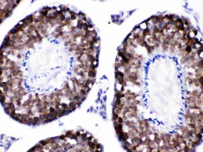 2 - Anti-CACYBP Antibody ABO12780