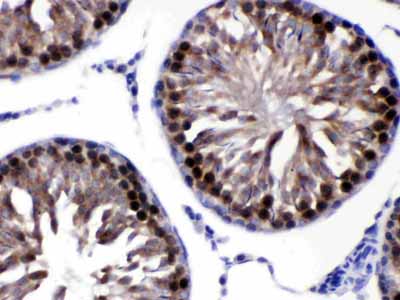 2 - Anti-CACYBP Antibody ABO12780