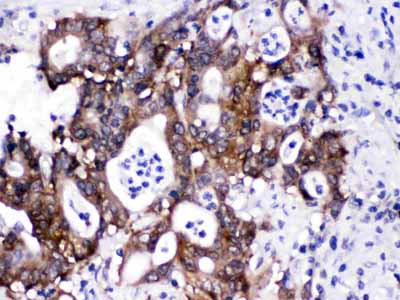 2 - Anti-CACYBP Antibody ABO12780