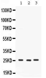 1 - Anti-CACYBP Antibody ABO12780