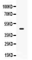 1 - Anti-CD33 Antibody ABO12781