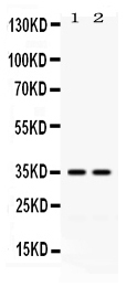1 - Anti-LFA3 Antibody ABO12782