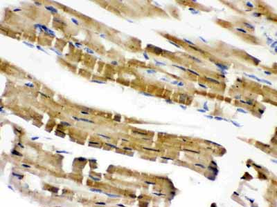 2 - Anti-Cofilin 2 Antibody ABO12783