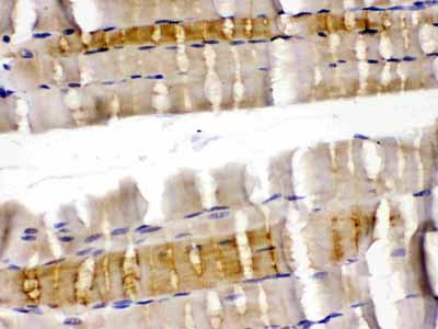 2 - Anti-Cofilin 2 Antibody ABO12783