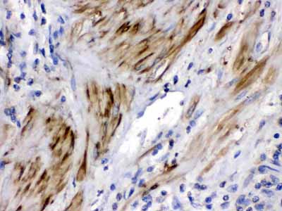 2 - Anti-Cofilin 2 Antibody ABO12783