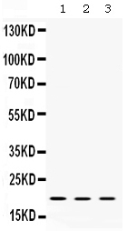 1 - Anti-Cofilin 2 Antibody ABO12783