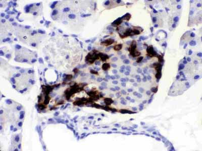 2 - Anti-VIP Antibody ABO12784