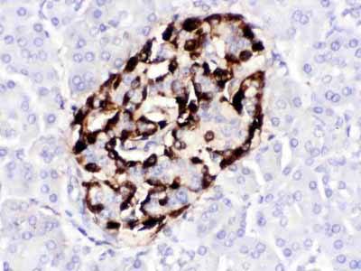 2 - Anti-VIP Antibody ABO12784