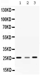 1 - Anti-SR1 Antibody ABO12786
