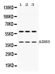 1 - Anti-ADH5 Antibody ABO12787