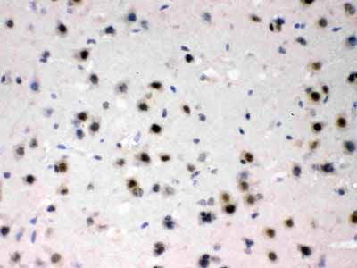 2 - Anti-AZIN2 Picoband Antibody ABO12788