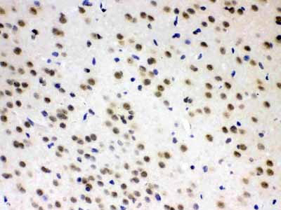 2 - Anti-AZIN2 Picoband Antibody ABO12788