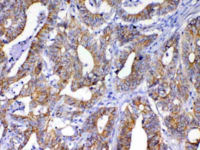 2 - Anti-beta Catenin Picoband Antibody ABO12789