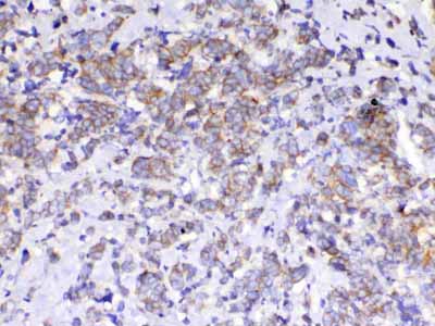 2 - Anti-beta Catenin Picoband Antibody ABO12789
