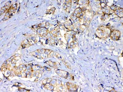 2 - Anti-beta Catenin Picoband Antibody ABO12789