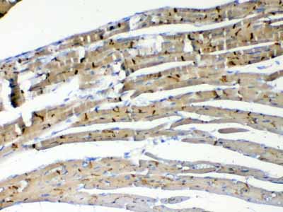 2 - Anti-beta Catenin Picoband Antibody ABO12789