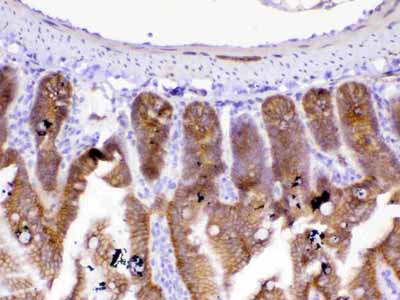 2 - Anti-beta Catenin Picoband Antibody ABO12789