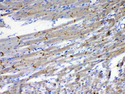 2 - Anti-beta Catenin Picoband Antibody ABO12789