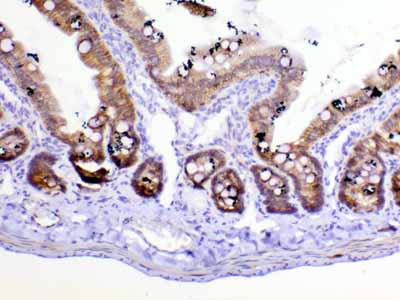 2 - Anti-beta Catenin Picoband Antibody ABO12789