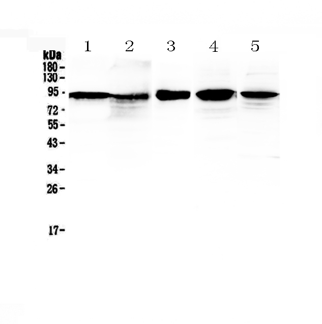 1 - Anti-beta Catenin Picoband Antibody ABO12789