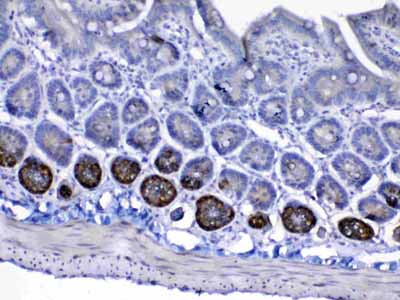 2 - Anti-IGF1 Receptor Picoband Antibody ABO12800